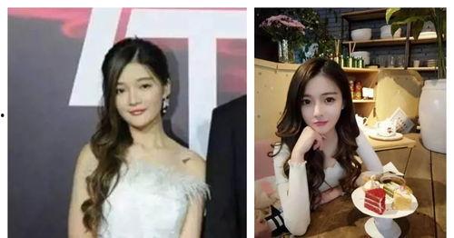 佘诗曼整容前后照片